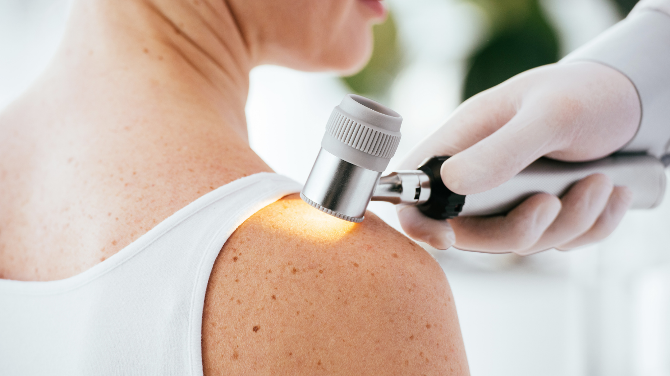 Dermatologo esegue una mappatura dei nei con dermatoscopio presso Medical Master Studio a Ottavia, Roma.